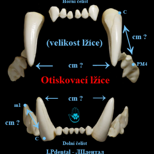1 Otiskovací lžíce(velikost lžíce)-LPdental -ЛПдентал.png