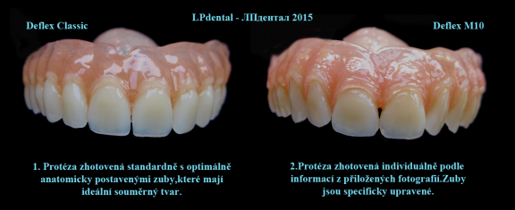 3 Dvě možnosti-standardně a individuálně zhotovená zubní náhrada..png