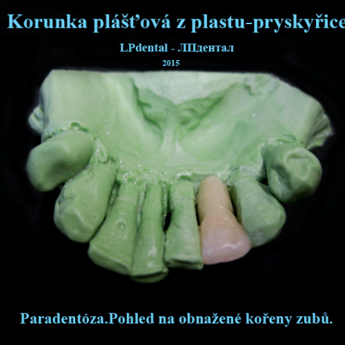 3 Korunka plášťová z plastu-pryskyřice..png