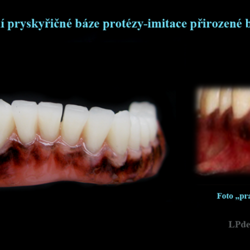 13 Dobarvování pryskyřičné báze protézy-physiologic-racial-pigmentation.png