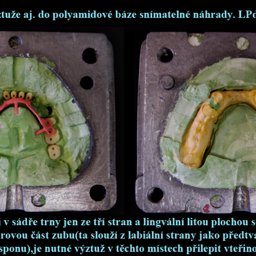 3 Vložení kovové výztuže do polyamidové báze..png