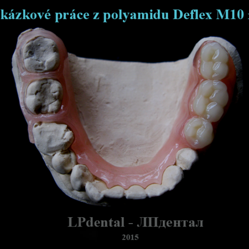 12 Ukázkové práce z polyamidu Deflex M10 (Nuxen S.r.l.) pro firmu Complete Dental.png