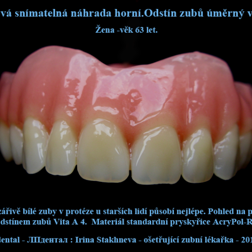 25 Odstín zubů uměrný věku pacientky .Irina Stakhneva,ošetřující zubní lékařka..png