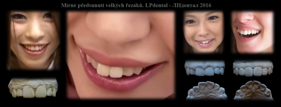 Mírně předsunuté řezáky.