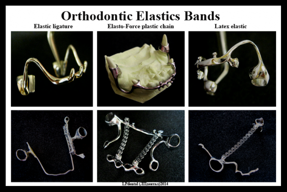 Orthodontic Elastics Bands.png
