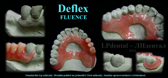 Deflex Fluence 4.png