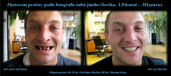 2 Pohled na situaci před zákrokem a po zákroku..png