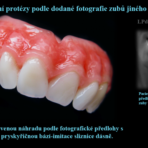 1 Zhotovení protézy podle fotografie zubů jiného člověka..png