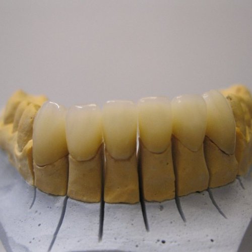 20 LP dental-korunky plášťové z kompozitního plastu.jpg