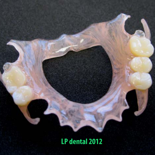28 LP dental -bezkovová snímatelná náhrada-Deflex.png