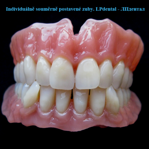 20 Individuálně souměrně postavené zuby..png