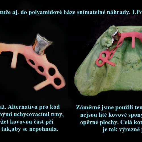 1 Vložení kovové výztuže do polyamidové báze..png