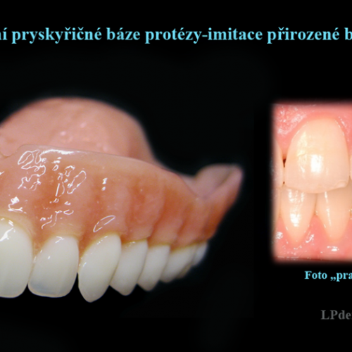 6 Dobarvování pryskyřičné báze protézy-imitace přirozené barvy dásně.png