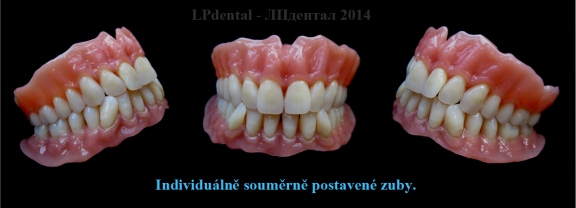 21 Možnosti v postavení zubů LPdental.png