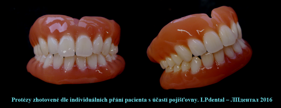 8 Protézy zhotovené dle individuálních přání pacienta s účastí pojišťovny..png