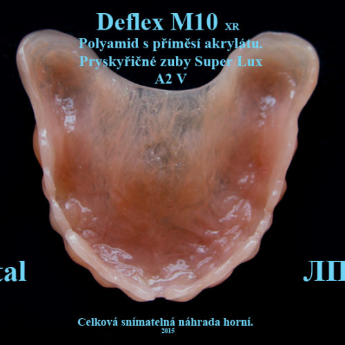 9 Deflex M10-celková snímatelná náhrada horní..png