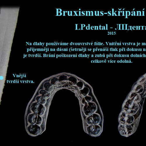 8 Bruxismus-dlahy proti skřípání zubů..png