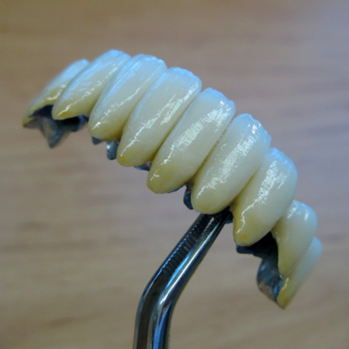 4  LP dental-keramický můstek-keramika NORITAKE ノリタケ.png