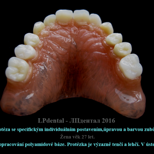 38 Protéza se specifickým individuálním postavením,úpravou a barvou zubů..png