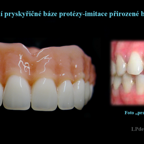 2 Dobarvování pryskyřičné báze protézy-imitace přirozené barvy dásně.png