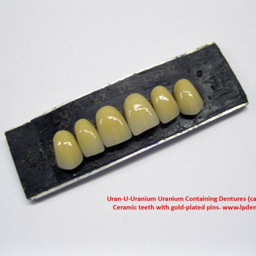 Uran-U-Uranium Containing Dentures ca.1950 Ceramic teeth with gold-plated pins. 5.jpg