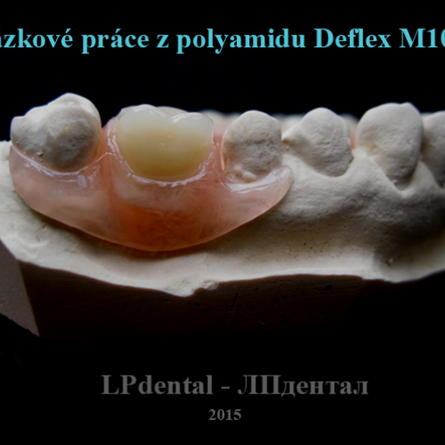 5 Ukázkové práce z polyamidu Deflex M10 (Nuxen S.r.l.) pro firmu Complete Dental.png