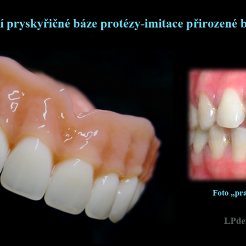 1 Dobarvování pryskyřičné báze protézy-imitace přirozené barvy dásně.png