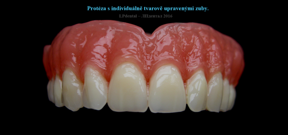18 Protéza s individuálně tvarově upravenými zuby..png