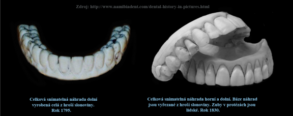 7-1 Protézy vyrobené z hroší slonoviny v kombinaci s lidskými zuby.png