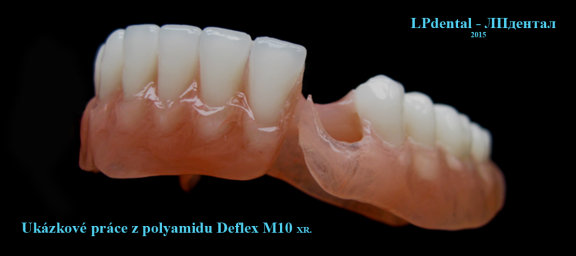 20 Ukázkové práce z polyamidu Deflex M10 (Nuxen S.r.l.) pro firmu Complete Dental.png