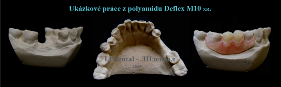14 Ukázkové práce z polyamidu Deflex M10 (Nuxen S.r.l.) pro firmu Complete Dental.png