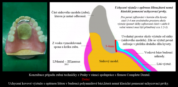 Uchycení kovové výztuže s opěrnou lištou do polyamidu,která nemá pomocné uchycovací trny..png