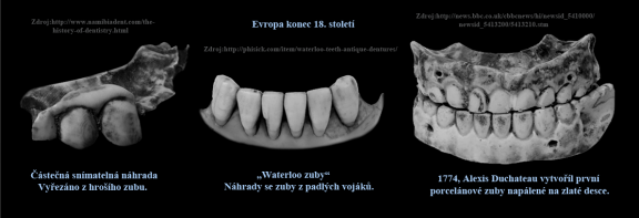 8 Waterloo zuby-první keramika.png