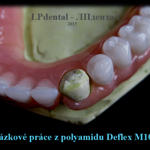 23 Ukázkové práce z polyamidu Deflex M10 (Nuxen S.r.l.) pro firmu Complete Dental.png