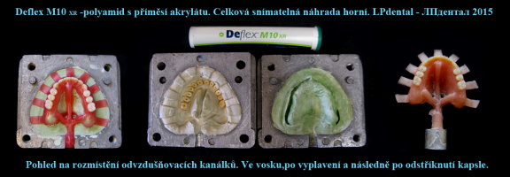 7 Deflex M10-celková snímatelná náhrada horní..png