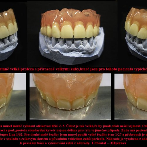 18-36 Velké protézy-náhrady s velkými zuby..jpg