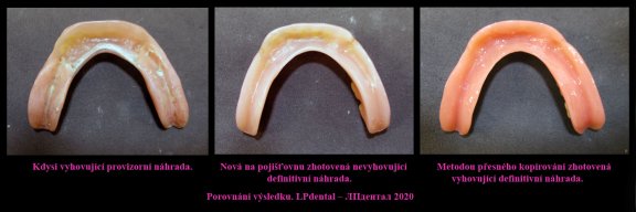5 Dolní celková protéza nedrží. Nedá se ani pořádně přilepit. Uvolňuje se při jídle..jpg