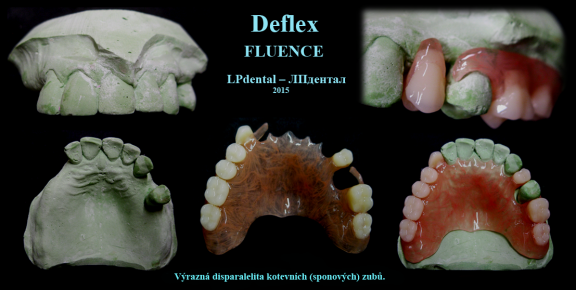 Deflex Fluence 2.png