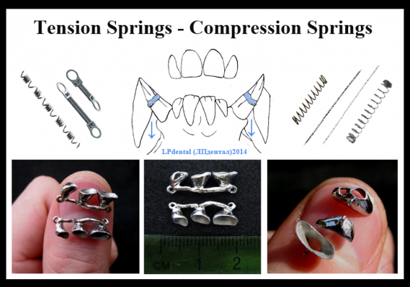 Tension Springs - Compression Springs.png