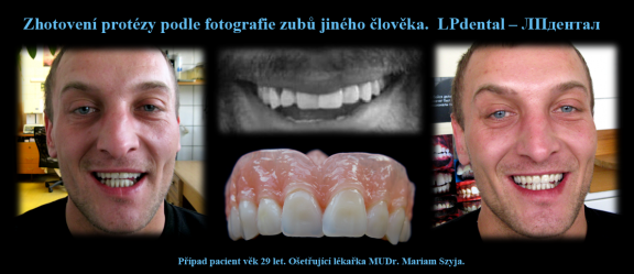 6 Zhotovení protézy s přihlédnutím k fotografii zubů jiného člověka..png
