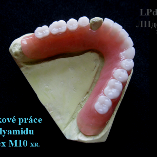 22 Ukázkové práce z polyamidu Deflex M10 (Nuxen S.r.l.) pro firmu Complete Dental.png