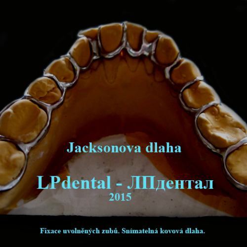 02 Jacksonova dlaha.png