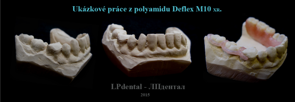 7 Ukázkové práce z polyamidu Deflex M10 (Nuxen S.r.l.) pro firmu Complete Dental.png