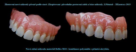 4 Nová zubní náhrada,která je zhotovená z deflexu M10..png