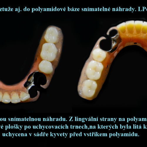 4 Vložení kovové výztuže do polyamidové báze..png
