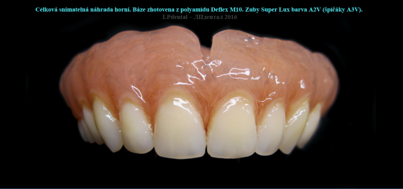 3 Protruze (Protrusion) zhotovení protézy podle starší fotografie s původním postavením zubů..png