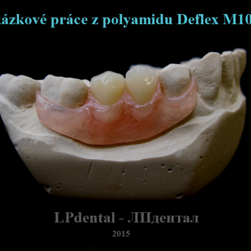 17 Ukázkové práce z polyamidu Deflex M10 (Nuxen S.r.l.) pro firmu Complete Dental.png