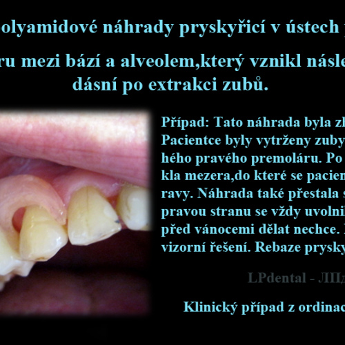 39 Oprava polyamidové náhrady pryskyřicí v ústech pacienta.Vyplnění prostoru mezi bází a alveolem..p