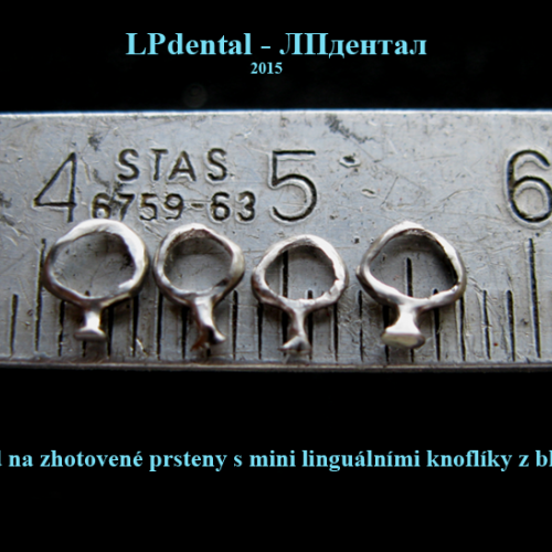 Kovové lité prsteny s knoflíky.