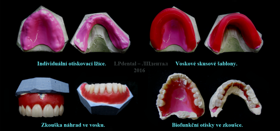 Základní fáze postupu..png